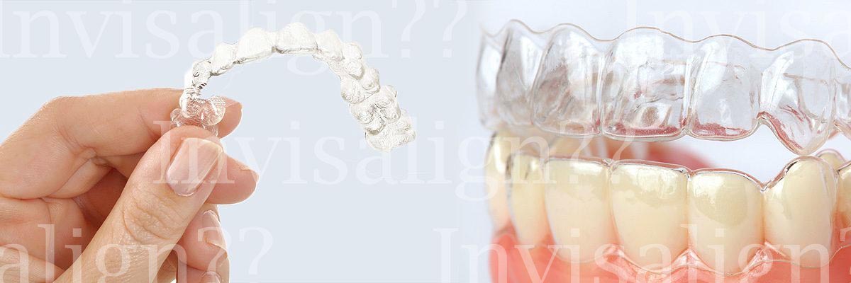 Portland Does Invisalign® Really Work?