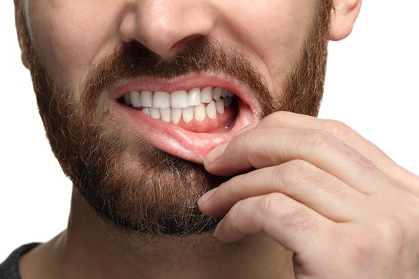 Periodontics: Protecting The Gums For A Healthier Smile