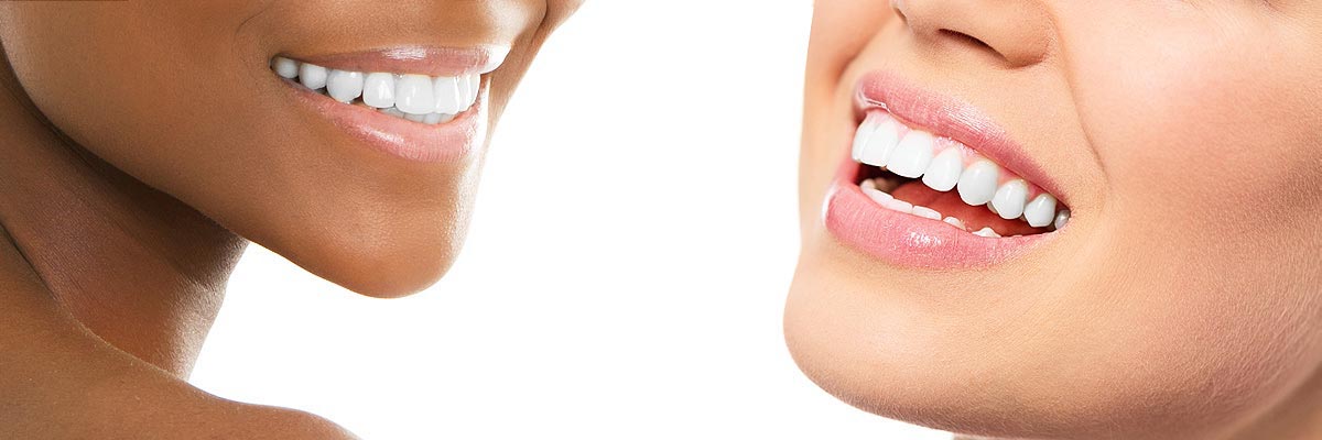 Portland Teeth Whitening