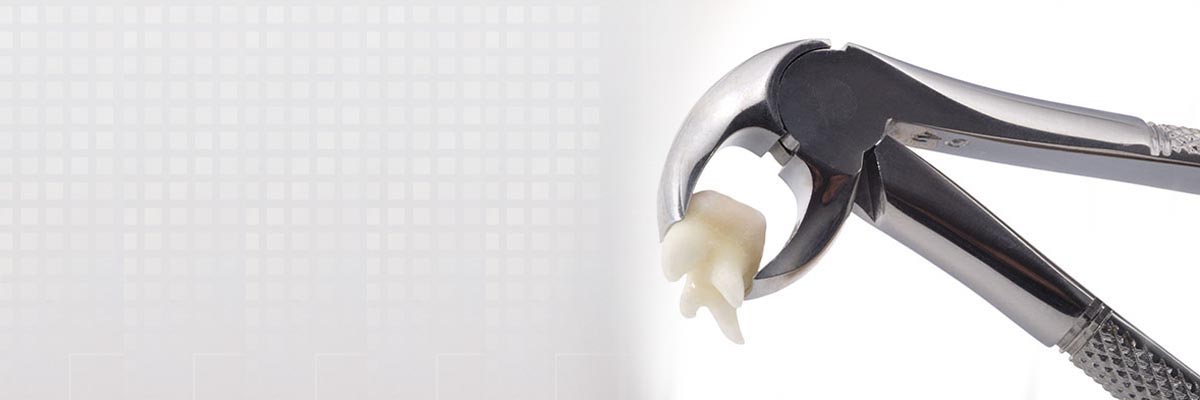 Portland Tooth Extraction